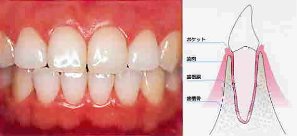 健康な歯